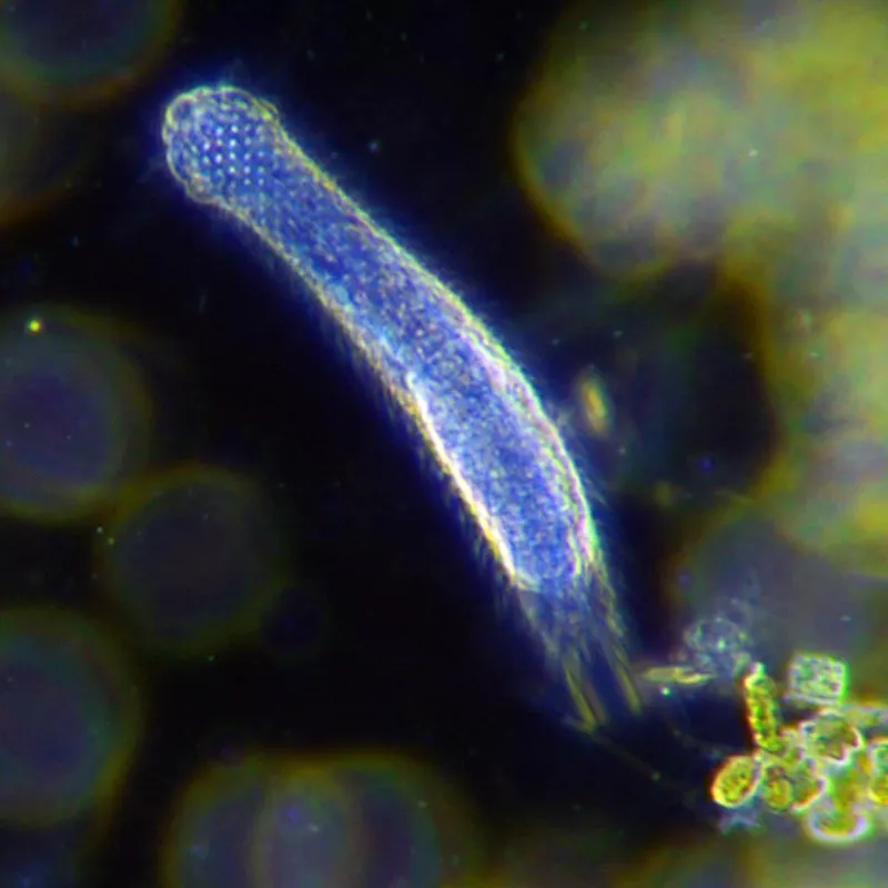 gastrotrich